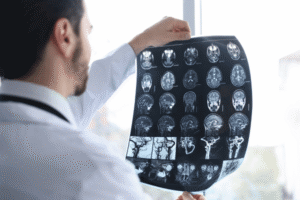 Anesthesia Errors and Brain Damage