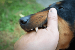Bitten by a Friend or Family Member’s Dog: Should I File a Claim?